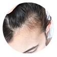 benefit/Prevents_hair_loss_and_promotes_hair_growth.webp